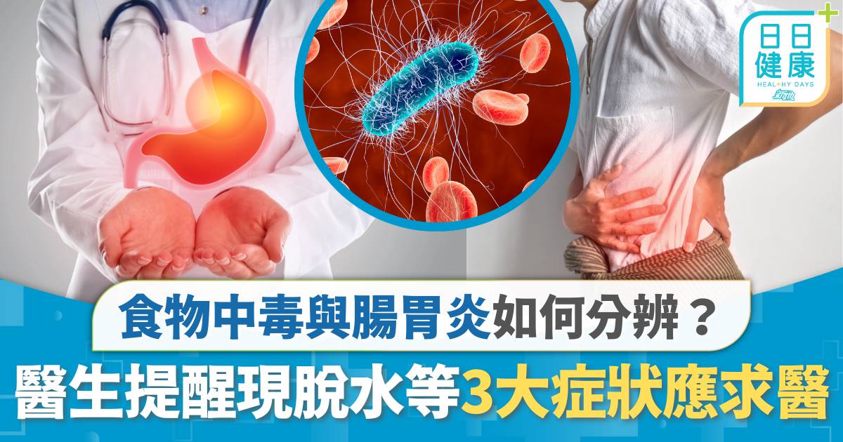 食物中毒與腸胃炎如何分辨？ 醫生提醒現脫水等3大症狀應求醫